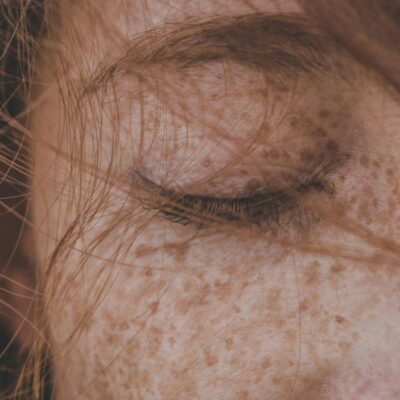 Manchas Escuras na Pele: Guia Definitivo para Clarear e Recuperar a Luminosidade — pele com manchas escuras o que fazer para