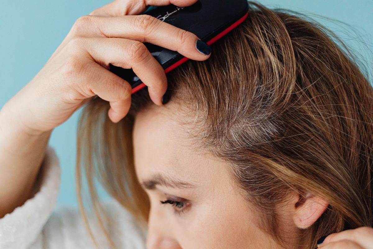 O que a ansiedade faz com o cabelo
